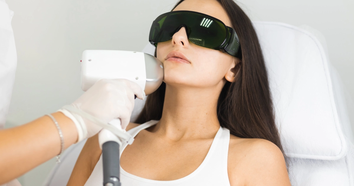 Woman with protective goggles receiving a cosmetic laser treatment on her chin by a technician in Princeton, WV